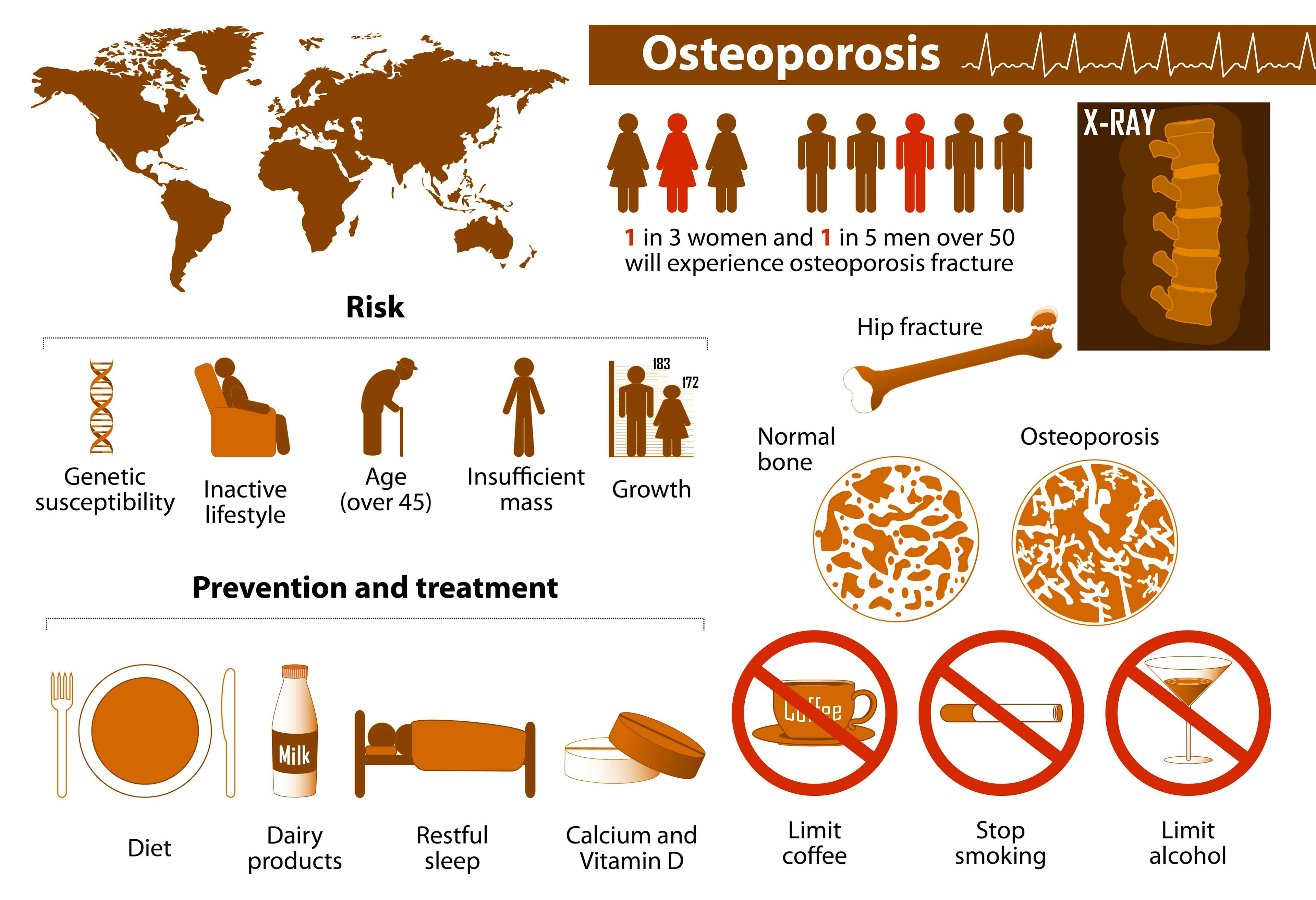 osteoporosis infographic | Image credit: designua - stock.adobe.com