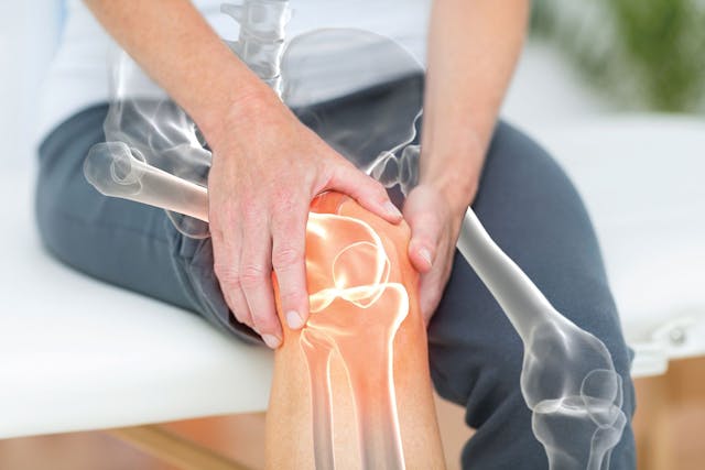 woman with arthritis in knee
