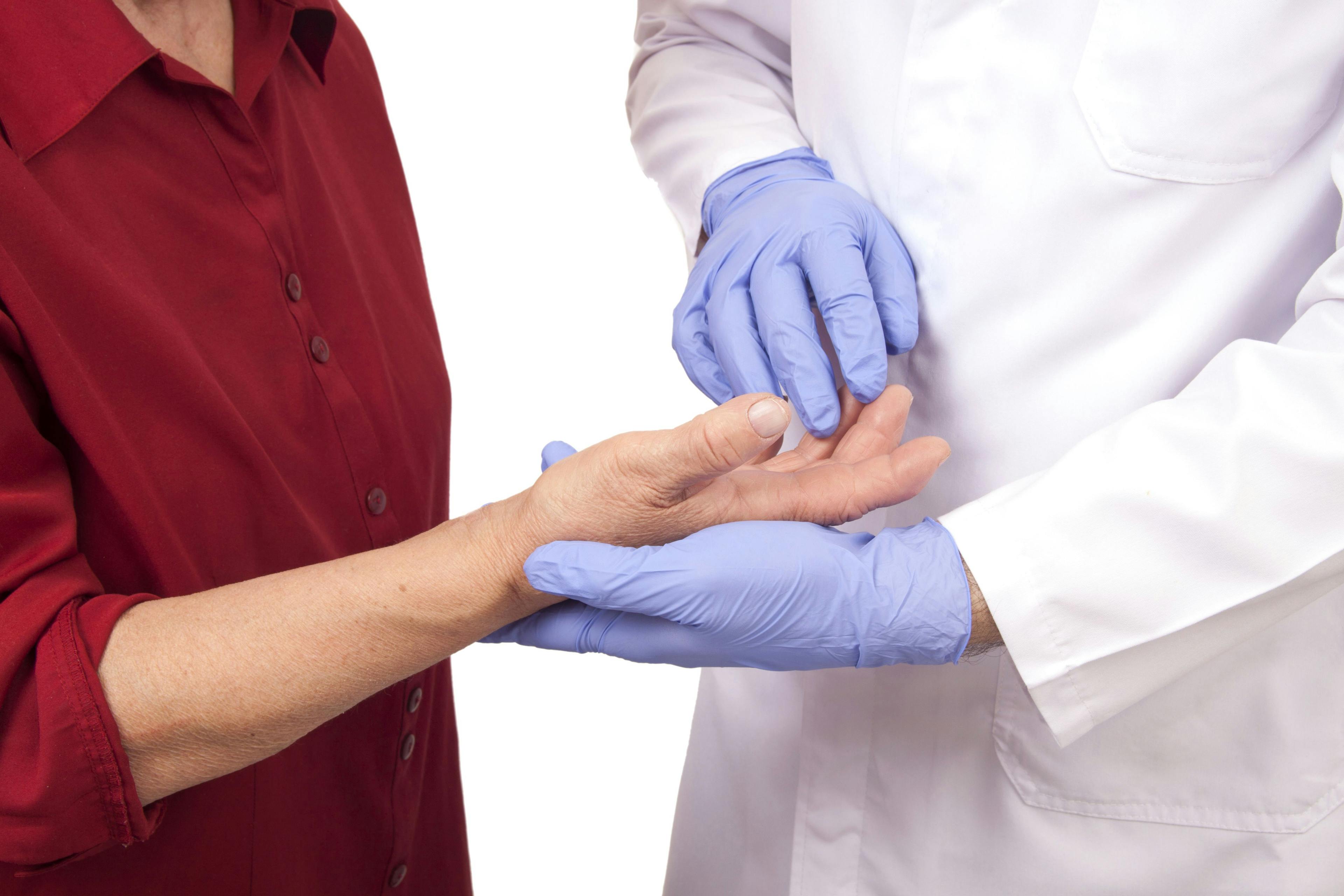 a health professional is examining a woman's hands