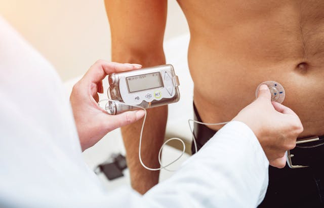 man being administered insulin pump