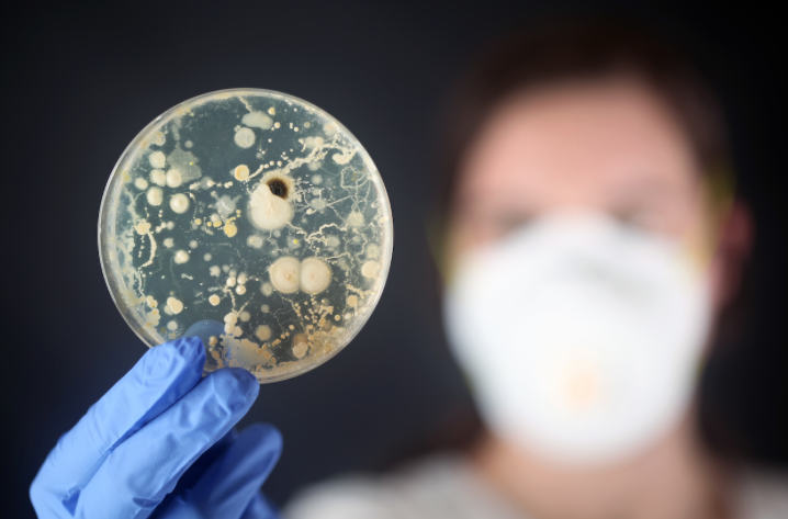 Could Microbiota Predict Response to Anti-TNF Agents in Spondyloarthritis?
