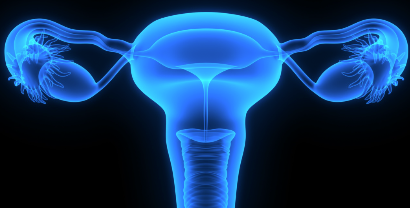 Bevacizumab Unlikely to Be Cost Effective in Ovarian Cancer, Canadian Analysis Finds
