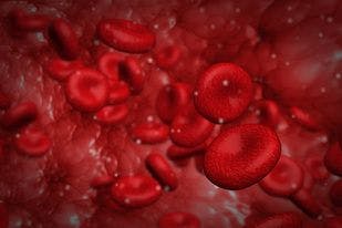 Review Highlights Biosimilar Epoetin Alfa in Treating Anemia in Myelodysplastic Syndromes