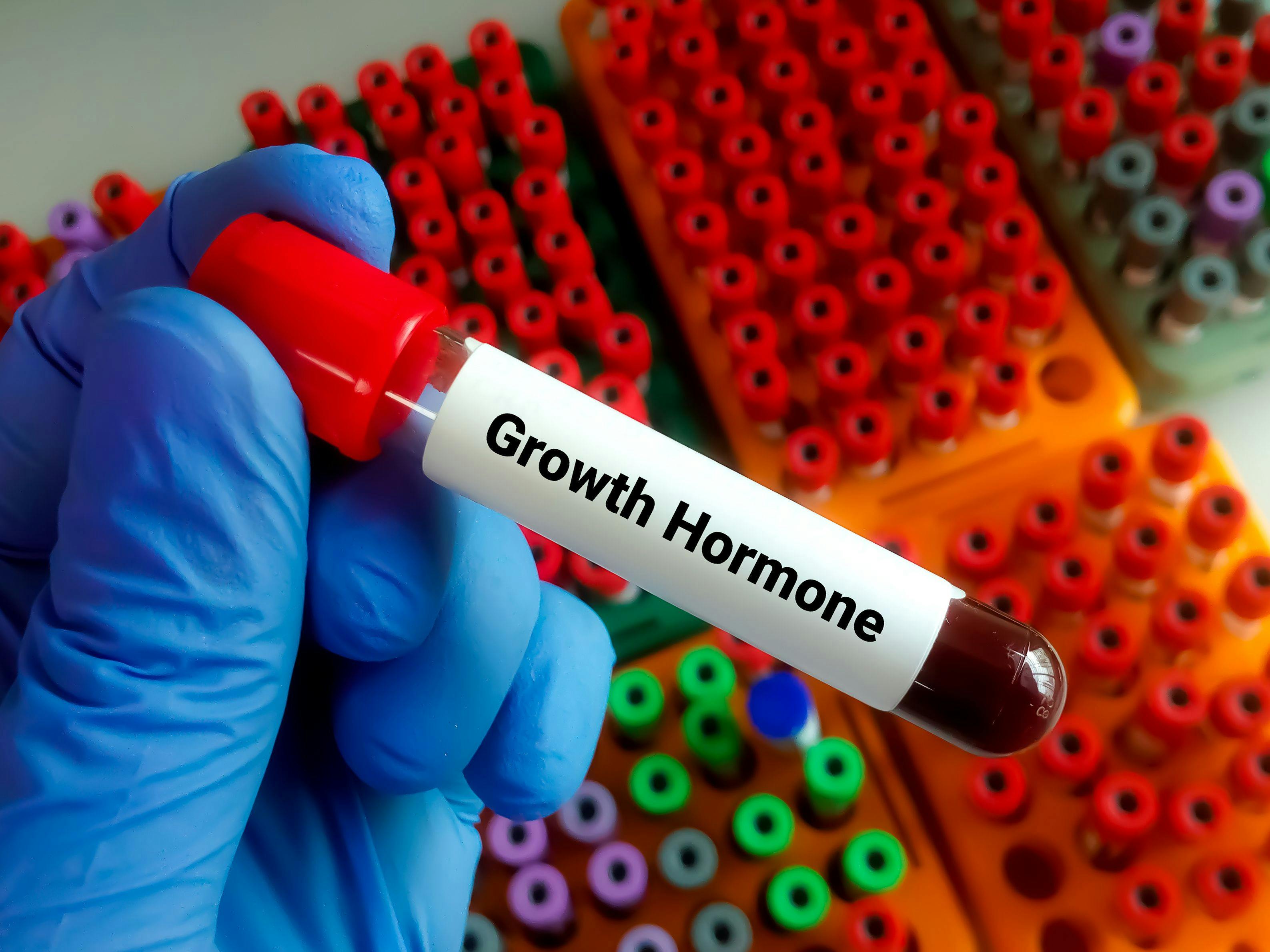 Blood sample for growth hormone test | Image Credit: Saiful52 - stock.adobe.com