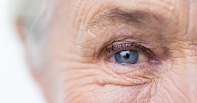 old woman eye | Image credit: Syda Productions - stock.adobe.com
