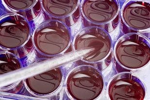 Transplant-Specific Outcomes Similar for Patients Treated With Biosimilar, Reference Filgrastim for Stem Cell Mobilization