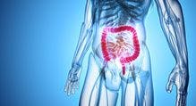 Largest Study to Date in Patients With IBD Finds Switch to CT-P13 Safe and Effective