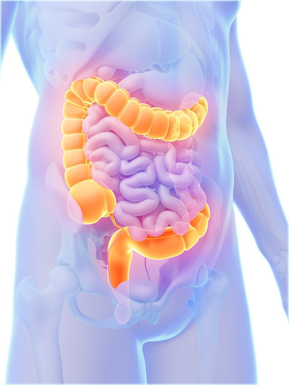 Risk of New IBD Rises for Patients Treated With Etanercept