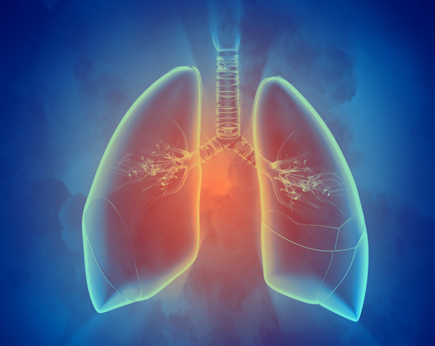 Study Finds No Evidence of Increased Pulmonary Toxicity With Bleomycin Plus Filgrastim